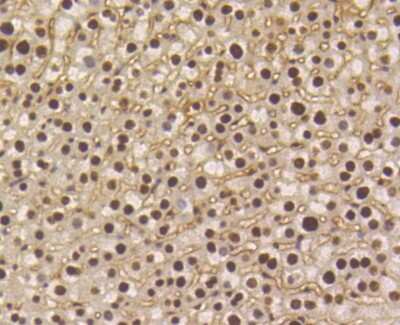 Immunohistochemistry-Paraffin: Smad5 [p Ser463, p Ser465] Antibody (SY09-03) [NBP2-67394] - Analysis of paraffin-embedded mouse liver tissue using anti-Phospho-Smad5(S463/465) antibody. Counter stained with hematoxylin.